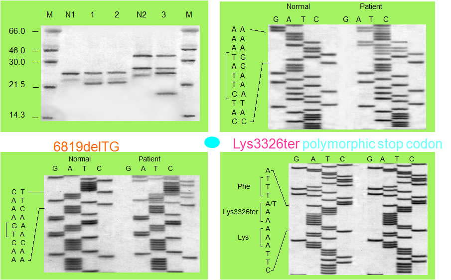 BRCA2 mutations